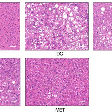 Hepatic Steatosis In Diabetic Mice Was Resolved By The WS PE Treatment