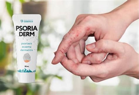 PsoriaDerm Gel De Hierbas Para La Psoriasis Opiniones Y Precio