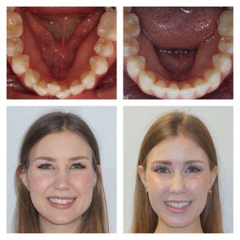 ATLANTA ORTHODONTIC SPECIALISTS Updated February 2025 15 Photos