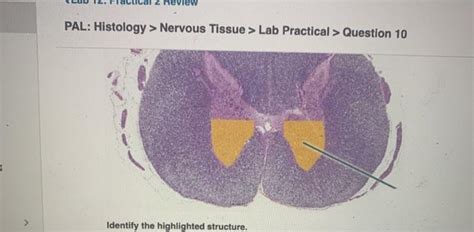 Solved Pal Histology Nervous Tissue Lab Practical Chegg