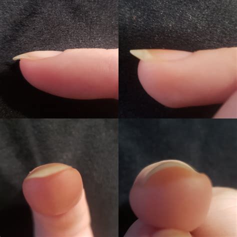 Rounded Curved Fingernails