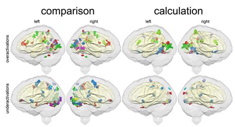 Significant Differences In Brain Activation Pattern For Individual