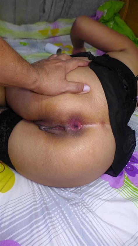 MY OPEN ASS AFTER AN ANAL 15 Nude Pics XHamster