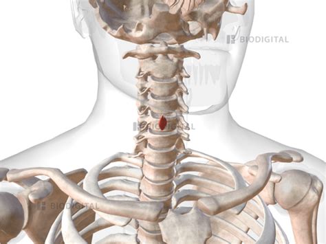 Right Posterior Cricoarytenoid BioDigital Anatomy