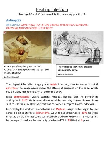 Aqa Gcse History Britain Health And The People Antiseptics Worksheets Teaching Resources