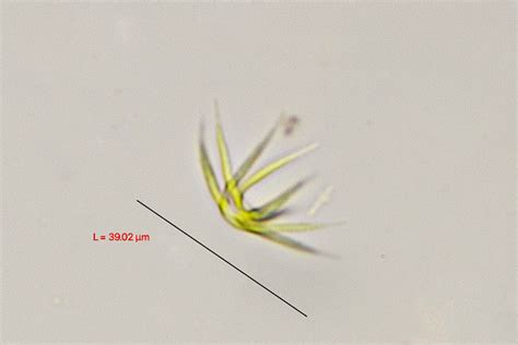 Ankistrodesmus densus | The Microscopic Life of Shetland Lochs