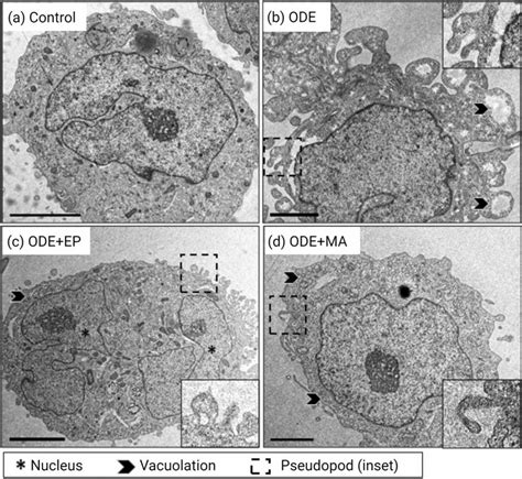 ODE Exposure Induces Differentiation Of THP1 Cells With Ultrastructural