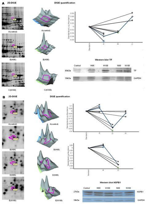 Expression Analyses Of Selected Proteins Using Decyder Software And Download Scientific Diagram