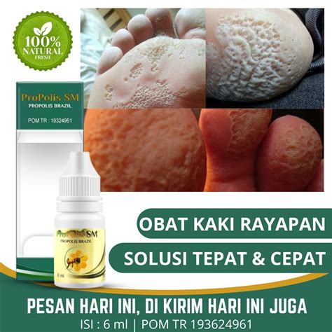 Jual Obat Oles Kaki Rayapan Obat Kaki Rayapan Bau Obat Kaki Rayapan