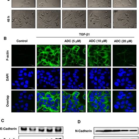 ADC blocks TGF β1 induced EMT in breast cancer cells MCF 7 cells were