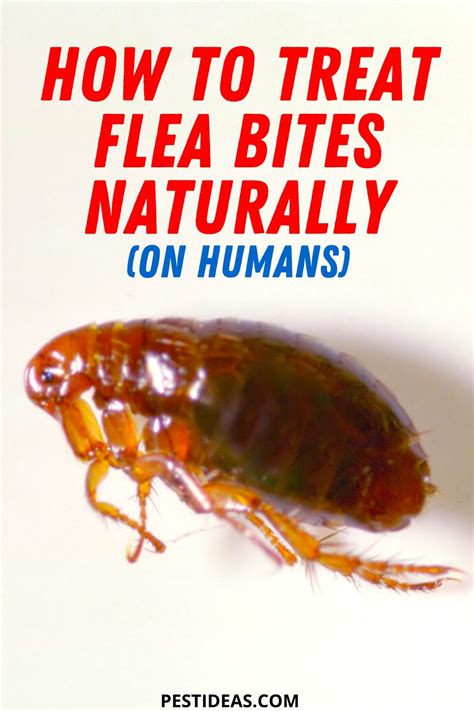 How to Treat Flea Bites- Get Rid of Fleas