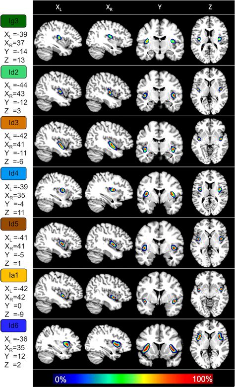 Researchers identify seven new areas in the insular cortex