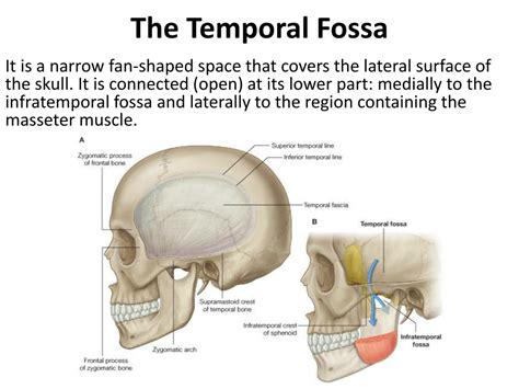 Ppt The Temporal Region And Temporo Mandibular Joint Tmj