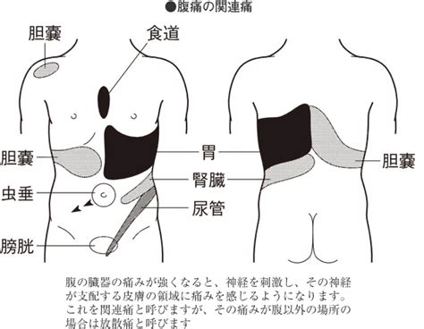 腹部の痛み家庭の医学時事メディカル時事通信の医療ニュースサイト