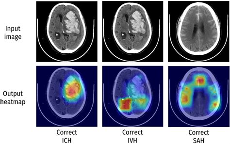 Evaluation Of Techniques To Improve A Deep Learning Algorithm For The