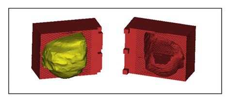 Visualization Of The Slicer Overlaid To The Mri Of The Prostate Imaged