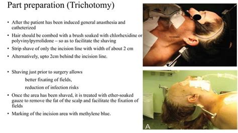 Pterional Craniotomy Ppt