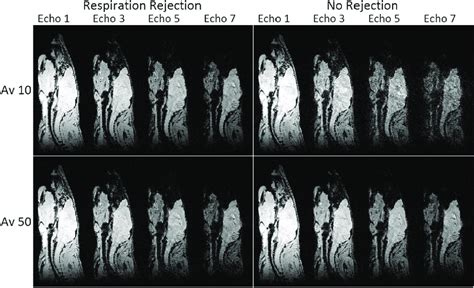 Sagittal Slices Taken From Mge D Scans Of A Na Ve Mouse Acquired With