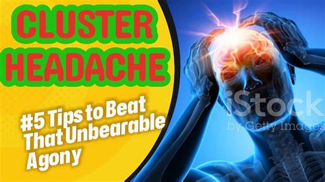 Beyond Pain Exploring Cluster Headaches 5 Tips To Beat That