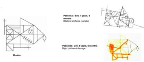 Neuropsychologie de l enfant Chapitre 1 Plasticité cérébrale troubles