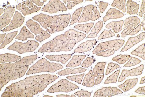 Ihceasy Lox Ready To Use Ihc Kit Khc0630 Proteintech 武汉三鹰生物技术有限公司