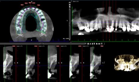 Cbct Advanced Scanning Technology In Canterbury