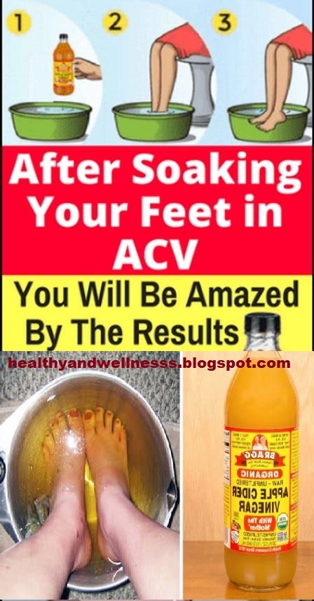 Soak Your Feet In Apple Cider Vinegar The Results Will Amaze You Health And Wellness