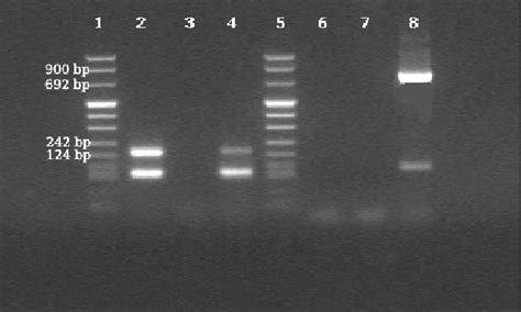 Detection Of Pcr Amplified Plasmodium Dna In Agarose Gel Lane Dna