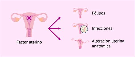 ¿qué Es La Esterilidad Femenina Síntomas Causas Y Tratamiento