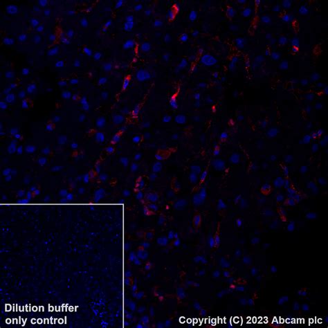 Alexa Fluor 555 Alexa Fluor 555 Anti Mannose Receptor Antibody