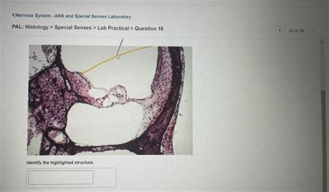 Solved Nervous System Ans And Special Senses Laboratory Chegg