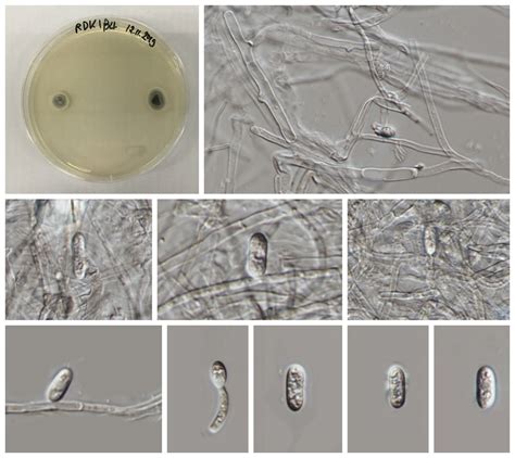 Colletotrichum Godetiae Facesoffungi Number FoF 03881 Faces Of Fungi