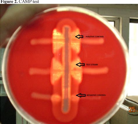 Pdf Streptococcus Agalactiae Causing Pyometra In An Elderly Female