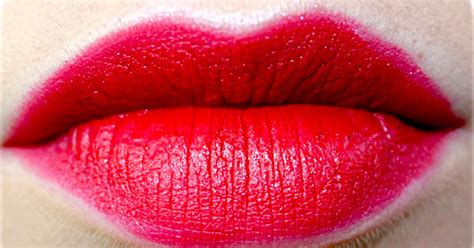 3 Easy Dry Cracked Lips Natural Remedies By Sonia Goyal