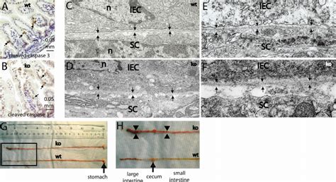 Lack Of Increased Intestinal Apoptosis Or Basement Membrane Disruption