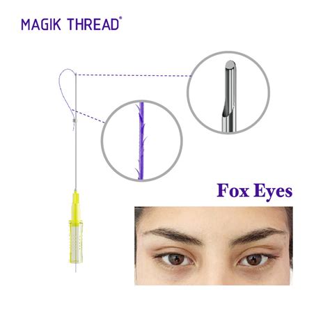 Magik Thread Non Surgical Pdo Thread Procedure Price Barbed Cog 4d Fox