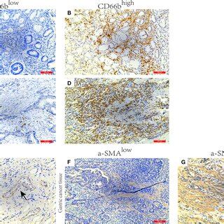 Immunohistochemical Images Of Sma And Cd B Expression In Gastric