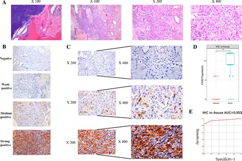 Hematoxylineosin HE Staining And Immunohistochemistry IHC Staining