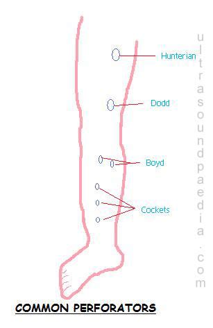 Venous Incompetence – ULTRASOUNDPAEDIA