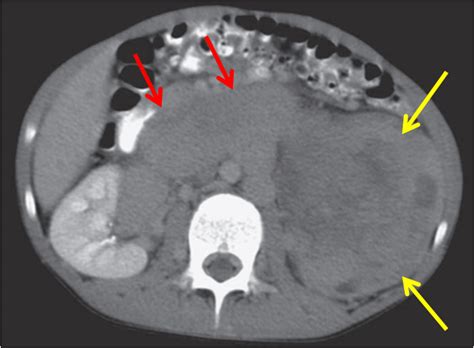 Pediatrics Radiologypics Com