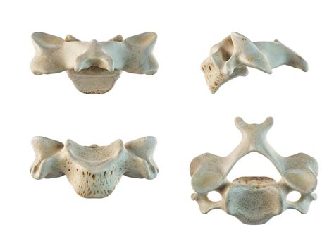 Typical Cervical Vertebrae Diagram Quizlet