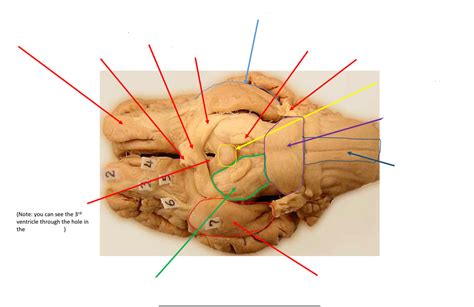 Neuroanatomy Lab Exam Diagram Quizlet