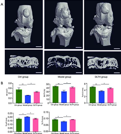 Micro CT Analysis Of DLTH Treated OA Mice Induced By DMM Surgery A