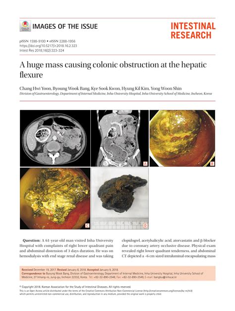 Pdf A Huge Mass Causing Colonic Obstruction At The Hepatic Flexure