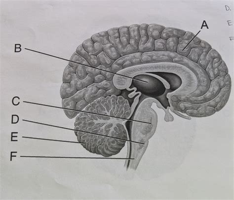 Lateral View Of Brain Diagram Quizlet