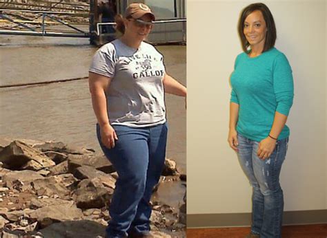 Tracy S Weight Loss Transformation St Louis Bariatrics