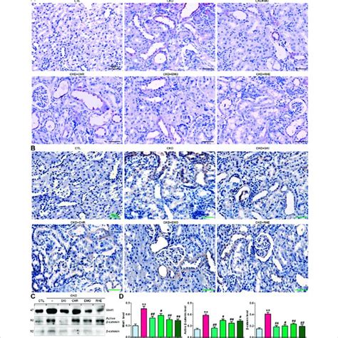 Ski Inhibited The Ras Wnt Catenin Signalling Axis In Angii Induced