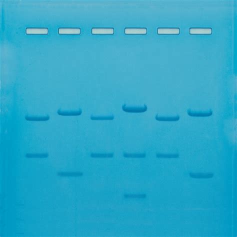 Dna Fingerprinting By Restriction Enzyme Patterns Fingerprint