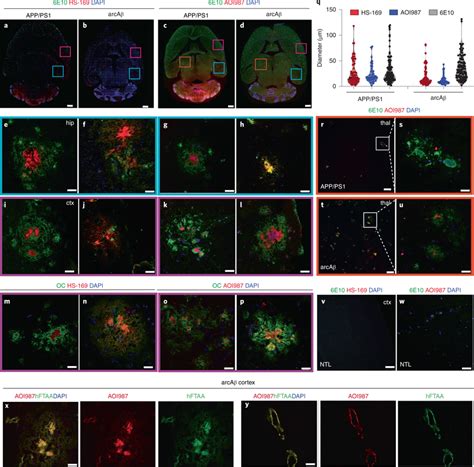 Staining for Aβ deposition in APP/PS1 and arcAβ mouse brain tissue ... 