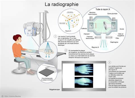 D Couvrir Comprendre L Imagerie M Dicale